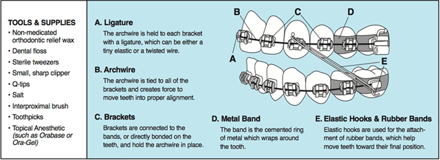 How to Manage Orthodontic Emergencies at Home
