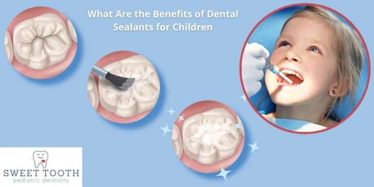 The Importance of Dental Sealants for Children’s Oral Health