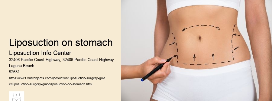 liposuction on stomach