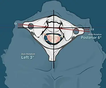 Upper Cervical Health Centers Upper Cervical Health Centers