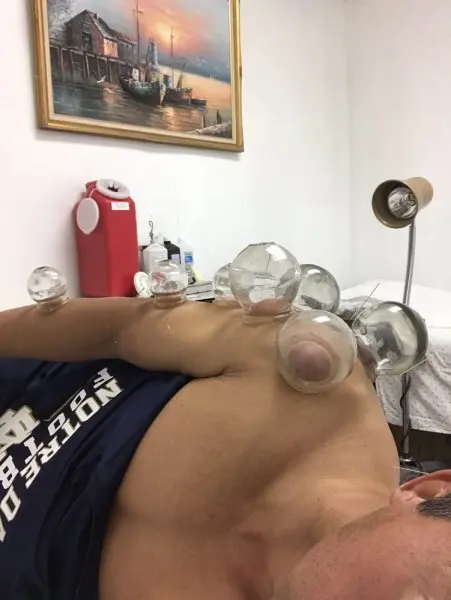 Acme Acupuncture Acme Acupuncture