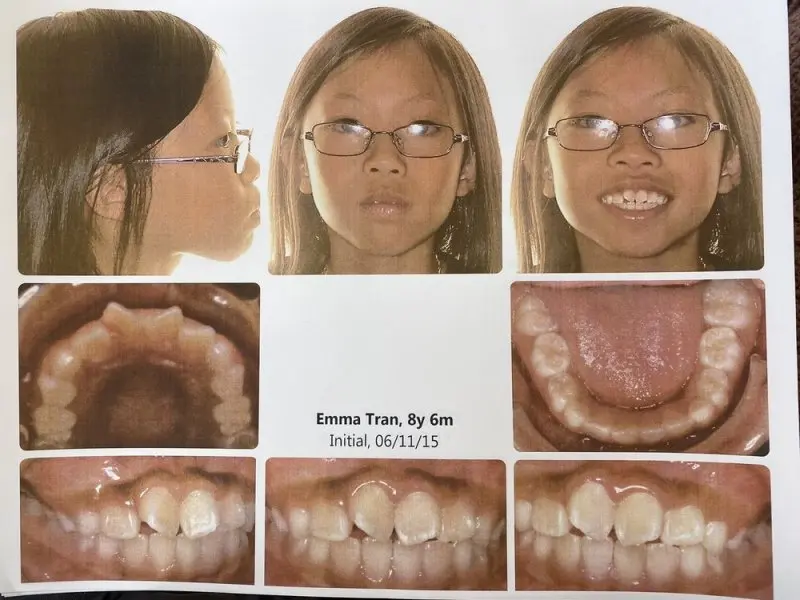 Zurcher Orthodontics Zurcher Orthodontics