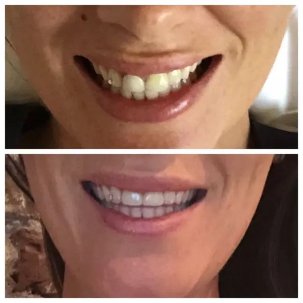 New Day Dentistry Centennial | Dr. Amanda Hudec, DMD New Day Dentistry Centennial | Dr. Amanda Hudec, DMD