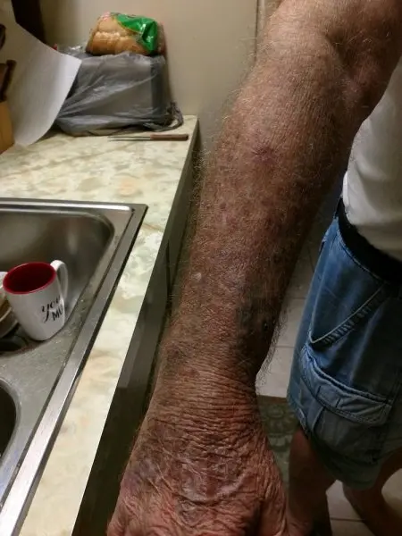 Advanced Dermatology & Cosmetic Surgery of Largo Advanced Dermatology & Cosmetic Surgery of Largo
