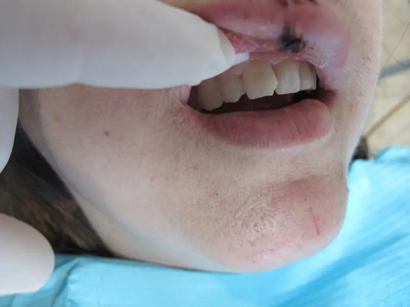 Aaron Payne, DDS Aaron Payne, DDS
