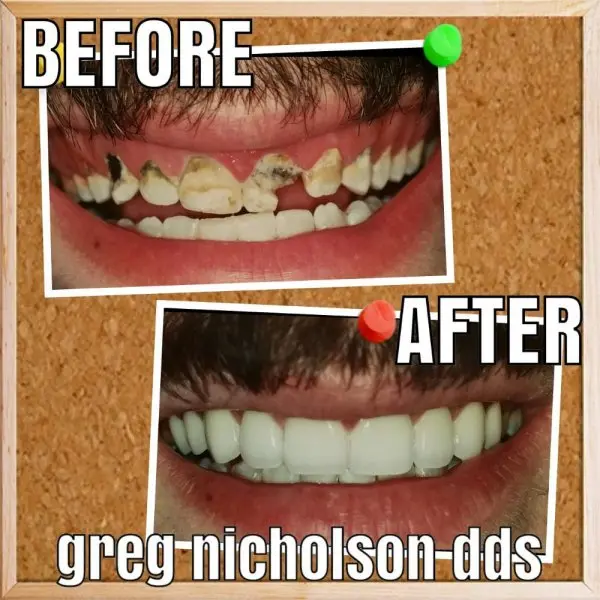 Cosmetic Dentistry of Murfreesboro Cosmetic Dentistry of Murfreesboro