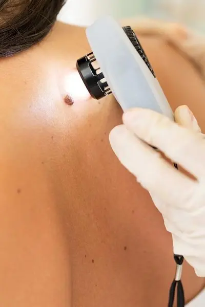 Nashville Dermatology & Skin Cancer Clinic Nashville Dermatology & Skin Cancer Clinic