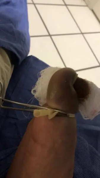 Adult & Children's Foot Care, Dr. Paul Resignato DPM Adult & Children's Foot Care, Dr. Paul Resignato DPM