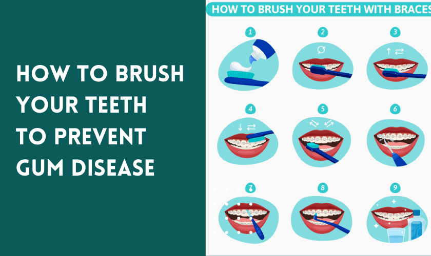 Gum Disease Prevention: Strategies to Keep Your Mouth Healthy