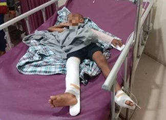 Bocah 5 Tahun Dianiaya Sebulan, Suami Istri Terancam Dibui 5 Tahun